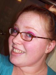January 11, 2009
[12 Days Post-Op]