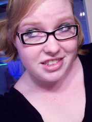 April 29, 2009
[17 weeks Post-Op]