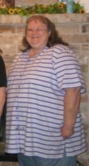 SuLain before surgery