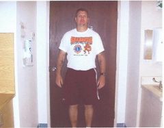 Post op pic.  June 2008
