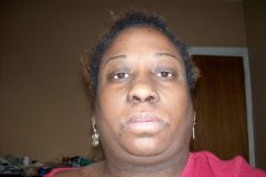 right after surgery