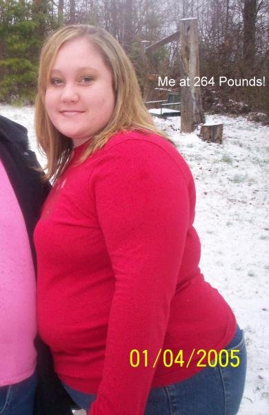 My progress before surgery!