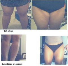 legsprogress