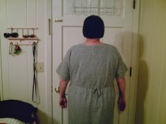 one week before surgery