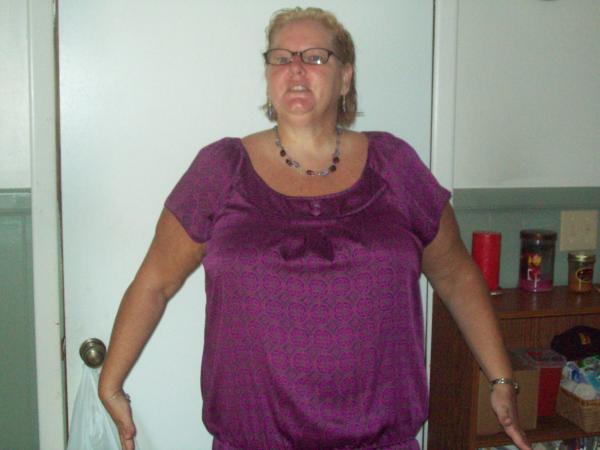 day before lapband surgery
