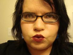8/28/09 4 days before surgery.