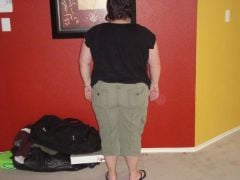 Day before surgery 8/31/09 250 lbs