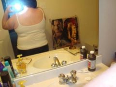 2 weeks post-op 32 lbs down. 240 lbs