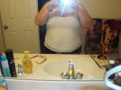 2 weeks post-op 32 lbs down 240 lbs