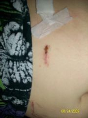the one that seems infected