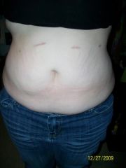 standing up (not even looking like lost weight which im pretty sure i havent...)