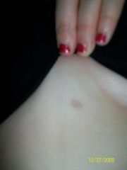 scars sorta looks like theyre starting to fade