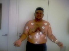 hospital stay2