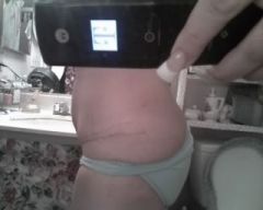 good side...i guesstimate my current weight to b between 157-159....3 weeks after panniculectomy and mini tuck