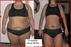 I hate posting this pics because I still have so far to go, but it's amazing to see the difference from where I was. 4 months post-surgery, down 56 lbs