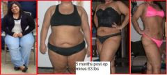 I apologize if my pics offend anyone, but I really want people to see how the process has been for me with at least some clothing on and to be honest, the granny panties just dont fit anymore. This is me, 5 months post surgery...still a work in progress. 