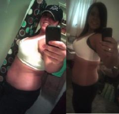 2 months and 15 lbs later (6 months and 8 months post op)