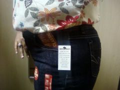 sixe 10 6mos after LapBand