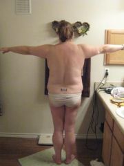 Night before surgery 8/19/09- Back view
222 lbs
I was feeling really ballsy to take this picture and show you guys!!!