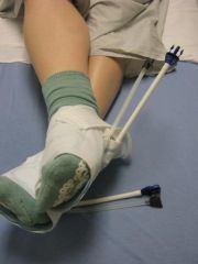 My pump boots!!!  To keep the circulation going in your feet and legs during surgery to avoid blood clots...