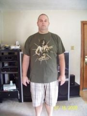 1 week post op front,
314 lbs here
