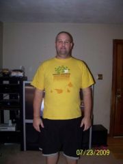 2 week post op front
305 lbs here