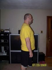 2week post op
305 lbs here