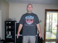 6 week post op front
298 lbs here first time under 300 in 13 years