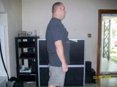 6 week post op side
298 lbs here first time under 300 in 13 years
