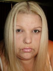 01 pre op 08/03/2009