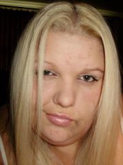 02 pre op 08/03/2009