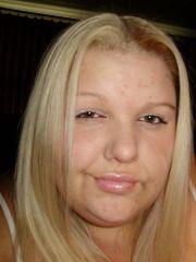 03 pre op 08/03/2009