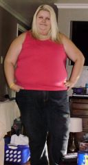 07 17d post op 08/21/2009 18lbs lost
