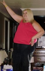 08 17d post op 08/21/2009 18lbs lost