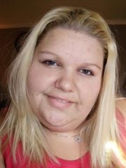 09 17d post op 08/21/2009 18lbs lost