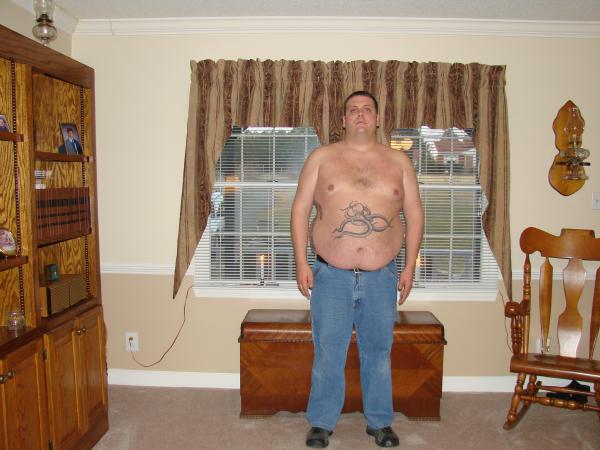 Jay before & after