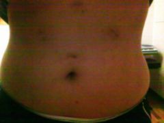 Ouchies. Well, not really. 'cept tht one to the far right. Portinesssssss.