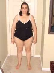 2 months POst op. -22lbs
