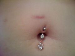 scar