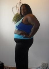 263LBS-STOMACH