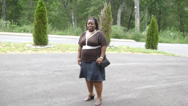 Before picture surgery date is 11/10/09
