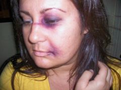 Halloween 09...yes it's makeup and yes, i purposly tried to look miserable...lol