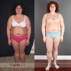 6 month post op.