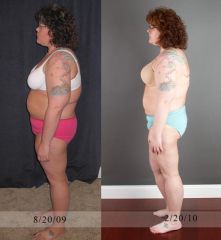 6 month post op.