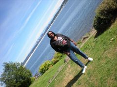 Me one month post-op ..... Surg Aug 09