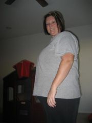 day before surgery 264
