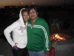 before surgery- july 09