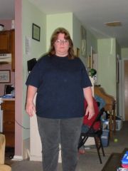 Before surgery. Taken in Sept, 2009. My surgery was Oct. 23, 2009