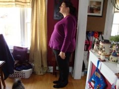 12/20 - 9 days post op - 272 pounds (10 pounds less)