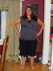 Four months post-op - 247 pounds